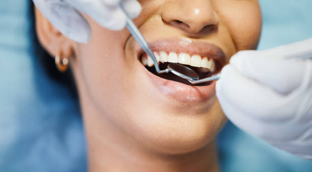 Best Emergency Tooth Extraction in Shadybrook, TX