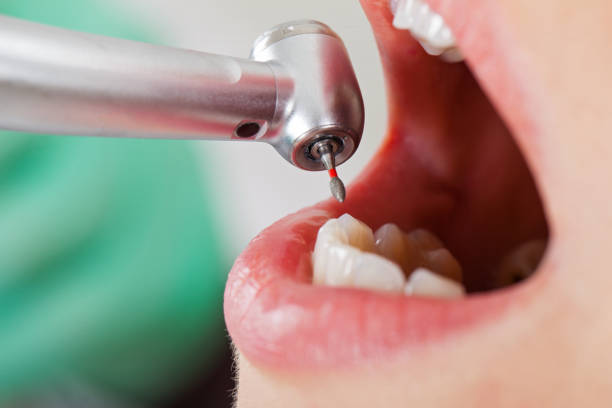 Best After-Hours Emergency Dentist in Shadybrook, TX